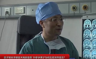 鼻子大手腳大耳朵大嘴唇厚！男子五官變丑“真兇”竟是垂體瘤