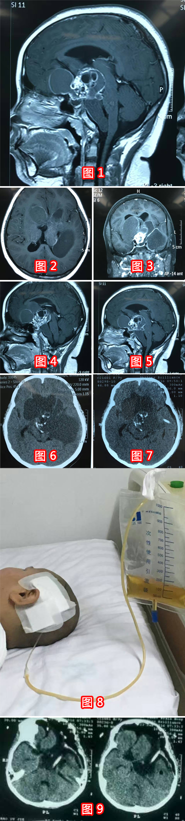 臺(tái)手術(shù)