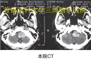 本院CT