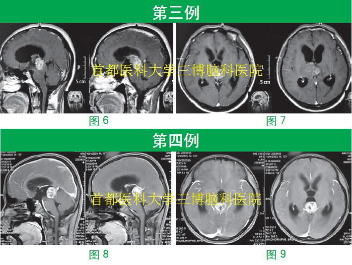 資料