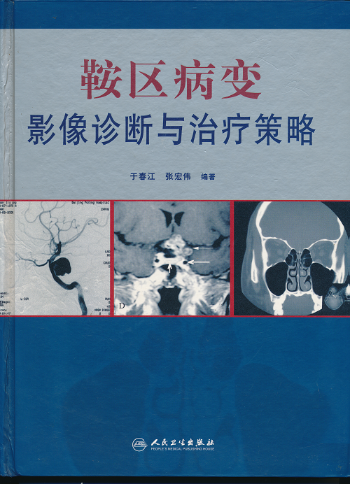 《鞍區(qū)病變影像診斷與治療策略》于春江、張宏偉編著