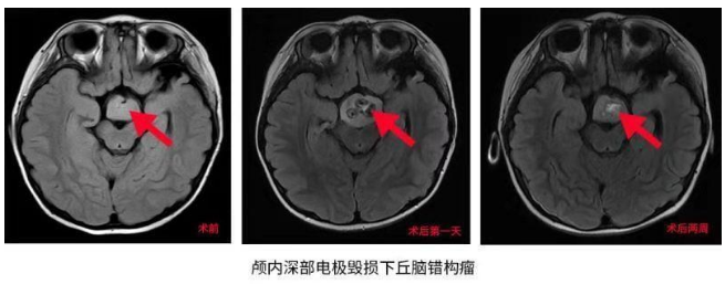 3歲女童愛笑性格好？她的“微笑”卻讓父母操碎了心