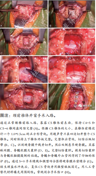 專訪范濤教授 - 唇亡齒寒： 脊髓脊柱外科的前世、今生與未來