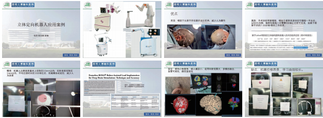 任杰：神經(jīng)外科手術(shù)機器人PK框架手術(shù)